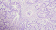 Granuloma in clam histopathology